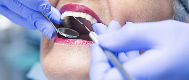 Best Dental Abscess Treatment in Fife Heights, WA